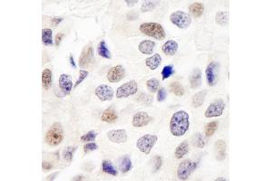 Immunohistochemistry (IHC) image for anti-Integrator Complex Subunit 7 (INTS7) (AA 850-900) antibody (ABIN7449405) (INTS7 抗体  (AA 850-900))