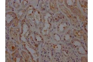IHC image of  diluted at 1:100 and staining in paraffin-embedded human kidney tissue performed on a Leica BondTM system. (Recombinant LRRK2 抗体)