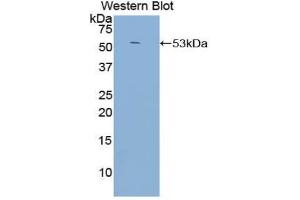 Western blot analysis of the recombinant protein. (CD21 抗体  (AA 729-957))