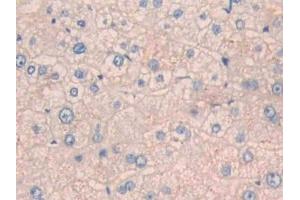 Detection of CPN1 in Human Liver Tissue using Polyclonal Antibody to Carboxypeptidase N1 (CPN1) (CPN1 抗体  (AA 159-325))
