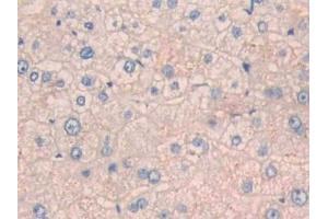Detection of CPN1 in Human Liver Tissue using Polyclonal Antibody to Carboxypeptidase N1 (CPN1) (CPN1 抗体  (AA 159-325))