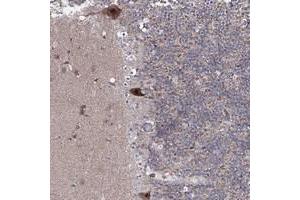 Immunohistochemical staining of human cerebellum with HOXC11 polyclonal antibody  shows strong cytoplasmic and nuclear positivity in purkinje cells at 1:50-1:200 dilution.