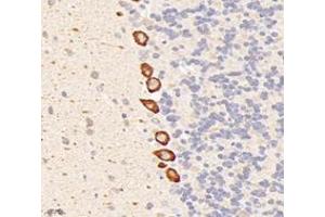Immunohistochemistry analysis of paraffin-embedded rat cerebellum using,Dgkz (ABIN7073722) at dilution of 1: 6000 (DGKZ 抗体)
