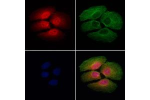 ABIN7094127 and ABIN7098171 staining Hela cells by IF/ICC.
