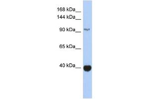 WB Suggested Anti-ZBTB4 Antibody Titration: 0. (ZBTB4 抗体  (Middle Region))