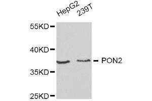 Western blot analysis of extracts of various cell lines, using PON2 antibody. (PON2 抗体  (AA 1-210))