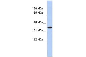 WB Suggested Anti-KLF6 Antibody Titration:  0. (KLF6 抗体  (N-Term))