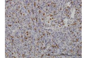 Image no. 1 for anti-Gardner-Rasheed Feline Sarcoma Viral (V-Fgr) Oncogene Homolog (FGR) (AA 1-90) antibody (ABIN598686) (Fgr 抗体  (AA 1-90))