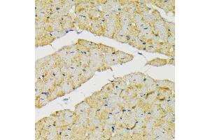 Immunohistochemistry of paraffin-embedded rat heart using Hexokinase II antibody (ABIN3021255, ABIN3021256, ABIN3021257 and ABIN6214088) at dilution of 1:200 (40x lens).