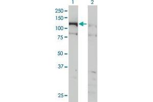 Lane 1: CHTF18 transfected lysate ( 107 KDa).