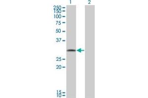 Western Blot analysis of FGFR1OP2 expression in transfected 293T cell line by FGFR1OP2 monoclonal antibody (M01), clone 2G4. (FGFR1OP2 抗体  (AA 62-169))