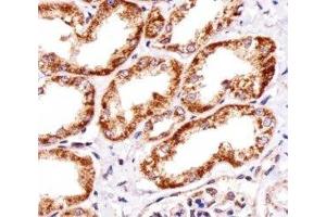 Immunohistochemical analysis of paraffin-embedded human kidney section using INSRR antibody; Ab was diluted at 1:25 dilution.