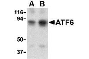 Western blot analysis of ATF6 in MDA-MB-361 cell lysate with this product atF6 antibody at (A) 0. (ATF6 抗体  (N-Term))
