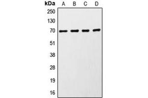 Western blot analysis of S6K1 expression in MCF7 (A), HeLa (B), HEK293 (C), mouse brain (D) whole cell lysates. (RPS6KB1 抗体  (C-Term))