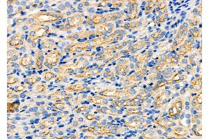 ABIN6260054 and ABIN6272249 at 1/100 staining Mouse kidney tissue by IHC-P. (ARRDC1 抗体  (C-Term))