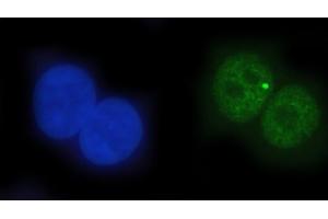 anti-tyrosyl-DNA phosphodiesterase 2 (TDP2) (AA 25-332) antibody