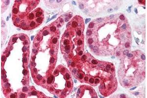 Human Kidney (formalin-fixed, paraffin-embedded) stained with CA2 antibody ABIN214579 at 5 ug/ml followed by biotinylated goat anti-rabbit IgG secondary antibody ABIN481713, alkaline phosphatase-streptavidin and chromogen. (CA2 抗体)