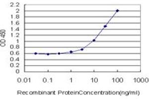 Detection limit for recombinant GST tagged GALT is approximately 0. (GALT 抗体  (AA 1-379))
