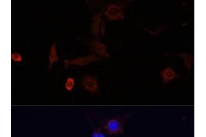Immunofluorescence analysis of PC12 cells using WDR81 Polyclonal Antibody at dilution of 1:100. (WDR81 抗体)