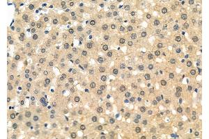 ABIN6264613 and ABIN6277733 at 1/100 staining Rat liver tissue by IHC-P. (RAD21 抗体  (C-Term))