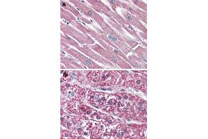 Immunohistochemical (Formalin/PFA-fixed paraffin-embedded sections) staining in human heart (A) and human adrenal gland (B) with SSTR5 polyclonal antibody . (SSTR5 抗体  (2nd Extracellular Domain))