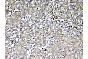 IHC analysis of GST3 / GST pi using anti-GST3 / GST pi antibody . (GSTP1 抗体  (AA 2-210))