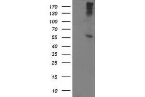 Western Blotting (WB) image for anti-ATPase, H+ Transporting, Lysosomal 56/58kDa, V1 Subunit B1 (ATP6V1B1) antibody (ABIN1496775) (ATP6V1B1 抗体)