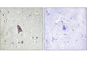 Immunohistochemistry analysis of paraffin-embedded human brain, using TIE2 (Phospho-Tyr1102) Antibody. (TEK 抗体  (pTyr1102))