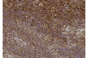 ABIN6276416 at 1/100 staining Mouse spleen tissue by IHC-P. (TRAF2 抗体  (C-Term))