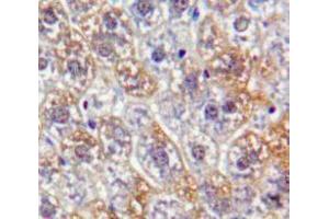 Used in DAB staining on fromalin fixed paraffin-embedded Liver tissue (PKN2 抗体  (AA 282-487))