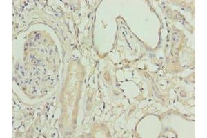 Immunohistochemistry of paraffin-embedded human kidney tissue using ABIN7158525 at dilution of 1:100 (ACSBG1 抗体  (AA 351-600))