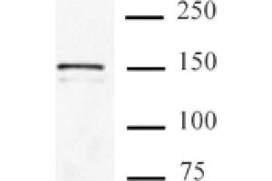 Cas9 antibody (mAb) tested by Immunoprecipitation. (CRISPR-Cas9 (N-Term) 抗体)