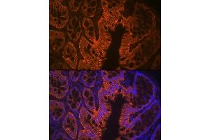 Immunofluorescence analysis of rat rectum using LI Cadherin/Cadherin-17 Rabbit mAb (ABIN7268249) at dilution of 1:100 (40x lens).