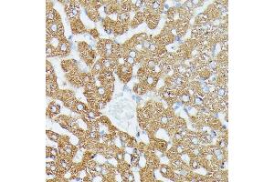 Immunohistochemistry of paraffin-embedded rat liver using MK1 antibody (ABIN7268647) at dilution of 1:100 (40x lens). (MAP3K1 抗体  (C-Term))