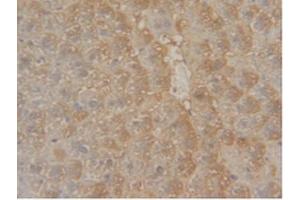 IHC-P analysis of Mouse Liver Tissue, with DAB staining. (GSTM1 抗体  (AA 1-218))
