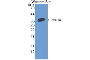 Western blot analysis of the recombinant protein. (RCN2 抗体  (AA 26-301))