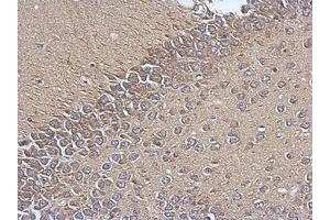 Image no. 1 for anti-Translocase of Inner Mitochondrial Membrane 17 Homolog A (TIMM17A) (AA 1-171) antibody (ABIN1501391) (TIMM17A 抗体  (AA 1-171))
