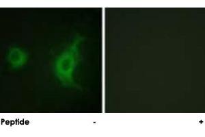 Immunofluorescence analysis of HUVEC cells, using KIF20A polyclonal antibody .