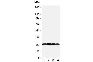 Western blot testing of BAG2 antibody (BAG2 抗体  (N-Term))