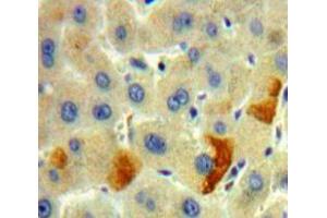 Used in DAB staining on fromalin fixed paraffin-embedded Liver tissue (FURIN 抗体  (AA 105-221))