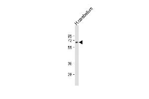 Anti-UGT2B4 Antibody (Center)at 1:2000 dilution + human cerebellum lysates Lysates/proteins at 20 μg per lane. (UGT2B4 抗体  (AA 338-370))