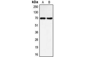 Western blot analysis of BLNK expression in Raji (A), LOVO (B) whole cell lysates. (B-Cell Linker 抗体  (Center))