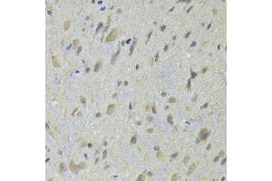 Immunohistochemistry of paraffin-embedded rat spinal cord using HDAC4 Antibody (ABIN5975864) at dilution of 1/100 (40x lens). (HDAC4 抗体)