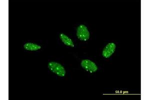 Immunofluorescence of purified MaxPab antibody to COIL on HeLa cell. (Coilin 抗体  (AA 1-576))