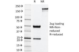 SDS-PAGE Analysis Purified NOX4 Mouse Monoclonal Antibody (NOX4/1245). (NADPH Oxidase 4 抗体)