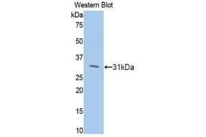 Western blot analysis of the recombinant protein. (PIK3CB 抗体  (AA 807-1070))