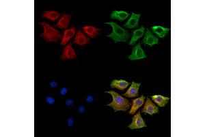 ABIN6261453 and ABIN6269282 staining HepG2 cells by IF/ICC. (EFNB1/2 (C-Term) 抗体)