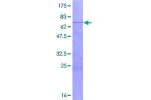 Desert Hedgehog (DHH) (AA 1-396) protein (GST tag)