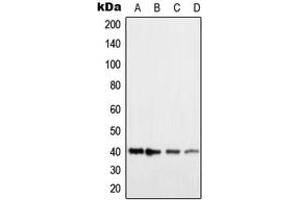 Western blot analysis of Histamine H2 Receptor expression in HEK293T (A), COLO205 (B), NIH3T3 (C), H9C2 (D) whole cell lysates. (HRH2 抗体  (Center))