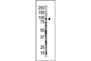 Image no. 1 for anti-Tousled-Like Kinase 1 (TLK1) (C-Term) antibody (ABIN360576) (TLK1 抗体  (C-Term))